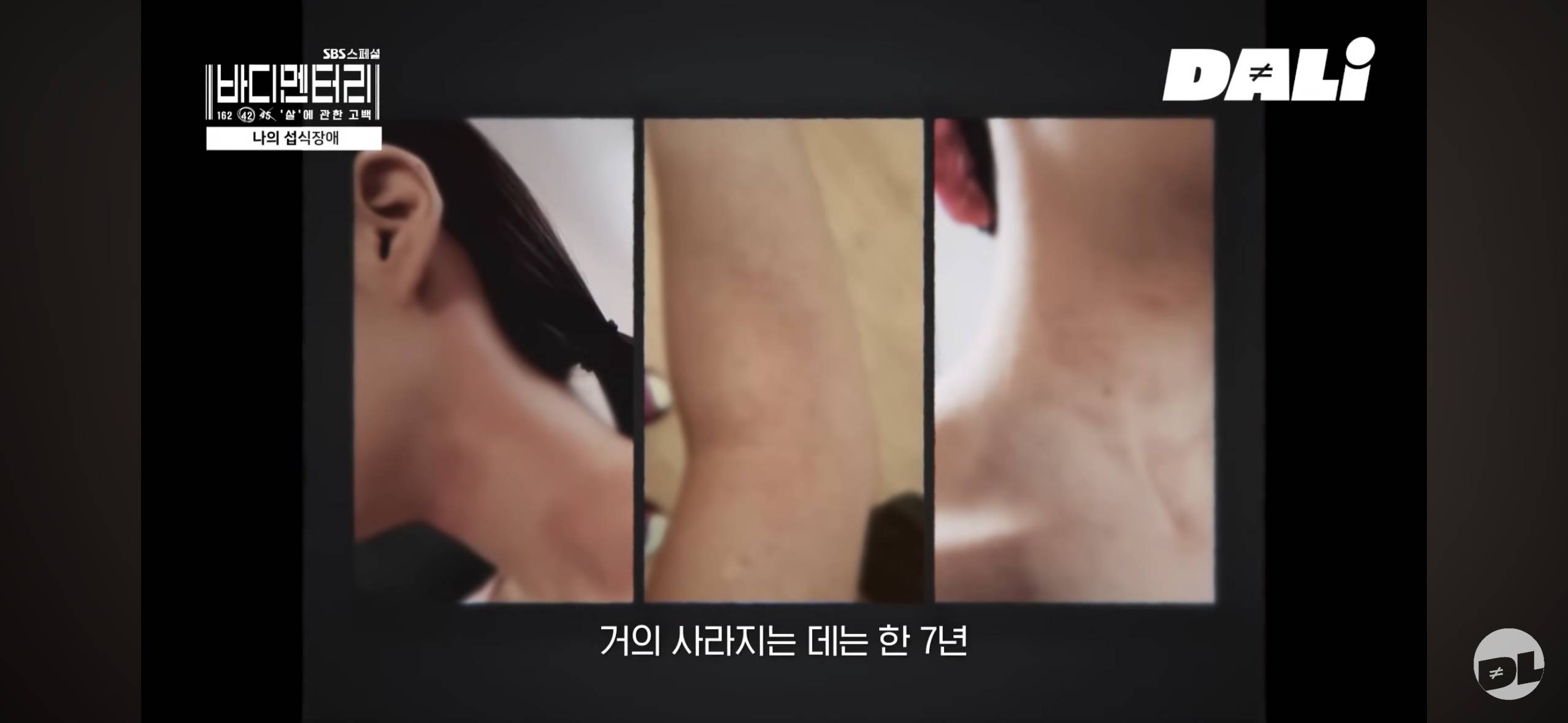 팬들이 리즈라고 극찬했던 그 시기 여돌들이 실제로 겪었던 식이장애 | 인스티즈