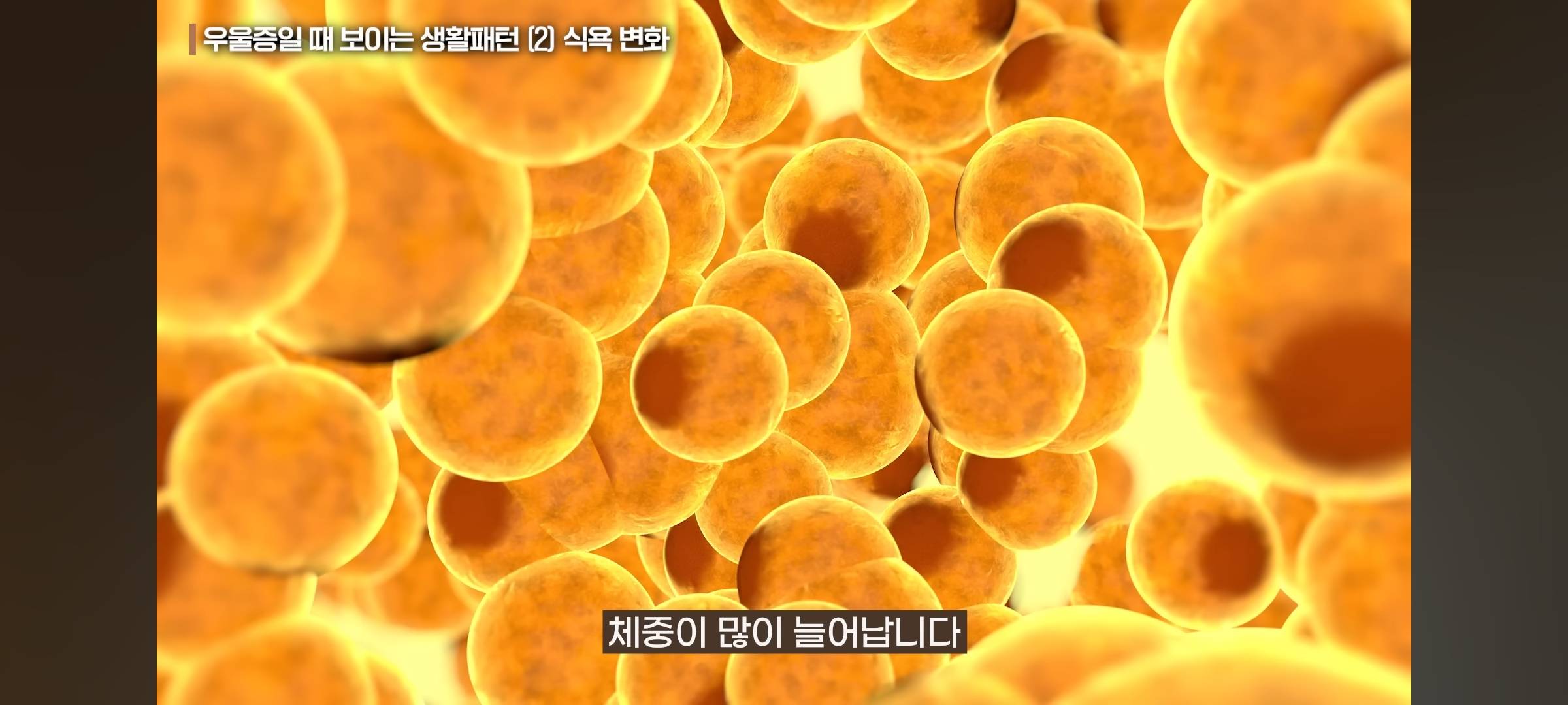 실시간 충격인 우울증 의외의 증상 | 인스티즈