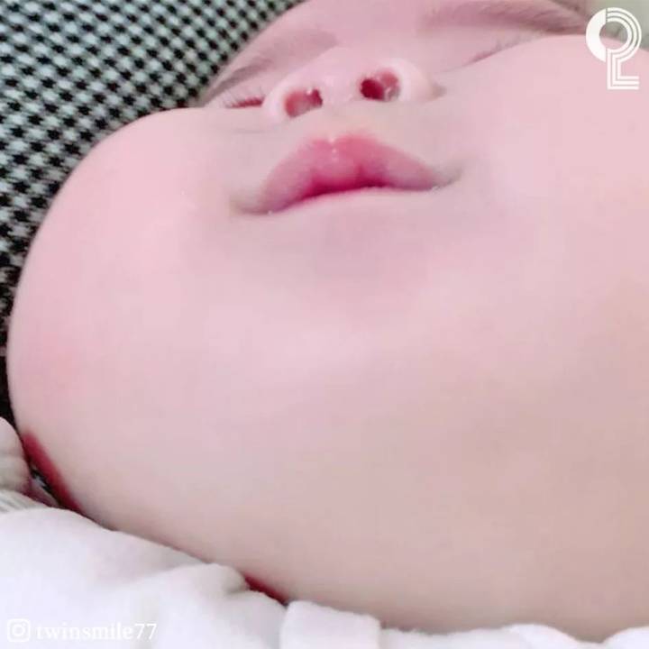 아기볼살 | 인스티즈
