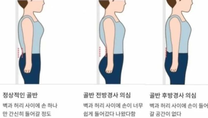 요즘 자주 보인다는 신체 증상.jpg | 인스티즈