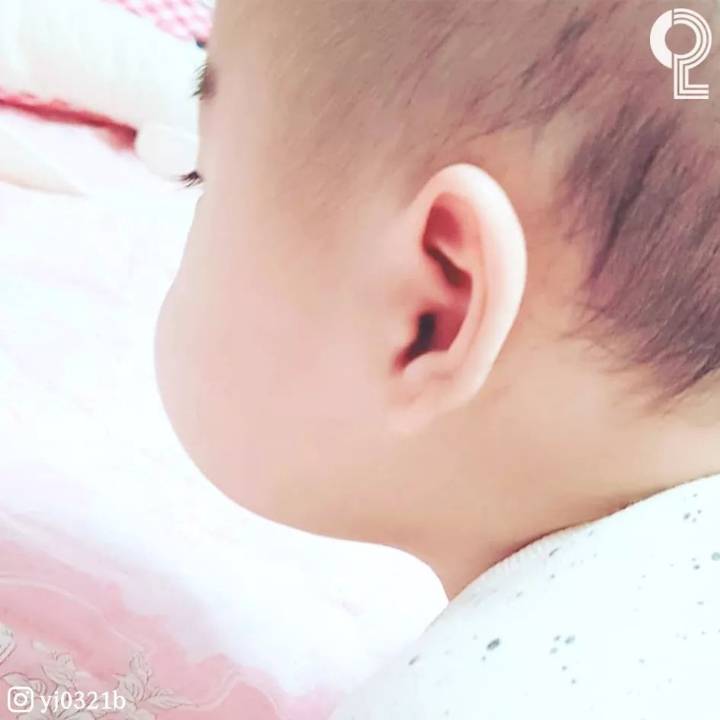 아기볼살 | 인스티즈