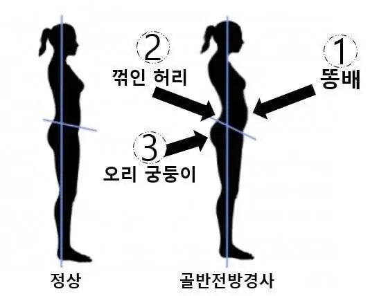 요즘 자주 보인다는 신체 증상.jpg | 인스티즈