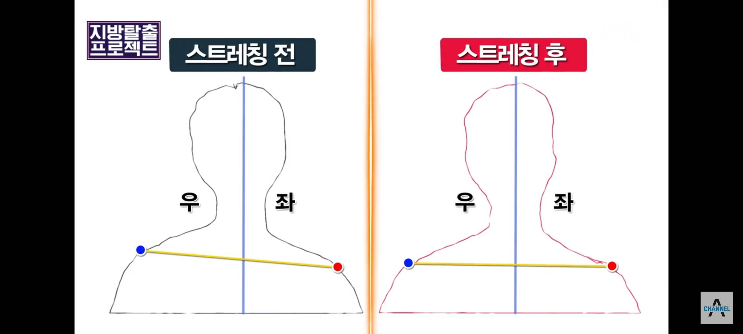 승모근 스트레칭 끝판왕 | 인스티즈