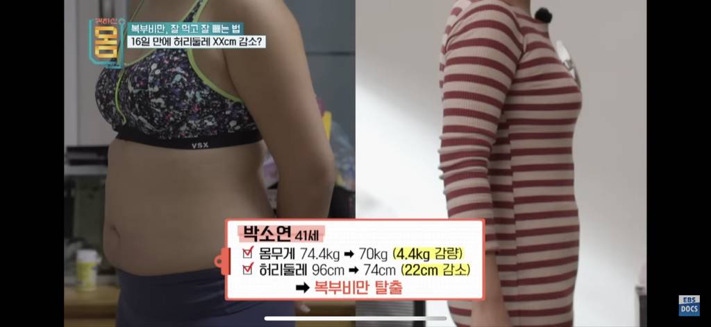 [EBS] 귀하신몸 - 복부비만 잘 먹고 잘 빼는 법 (16일동안 허리둘레 22cm 감소) | 인스티즈
