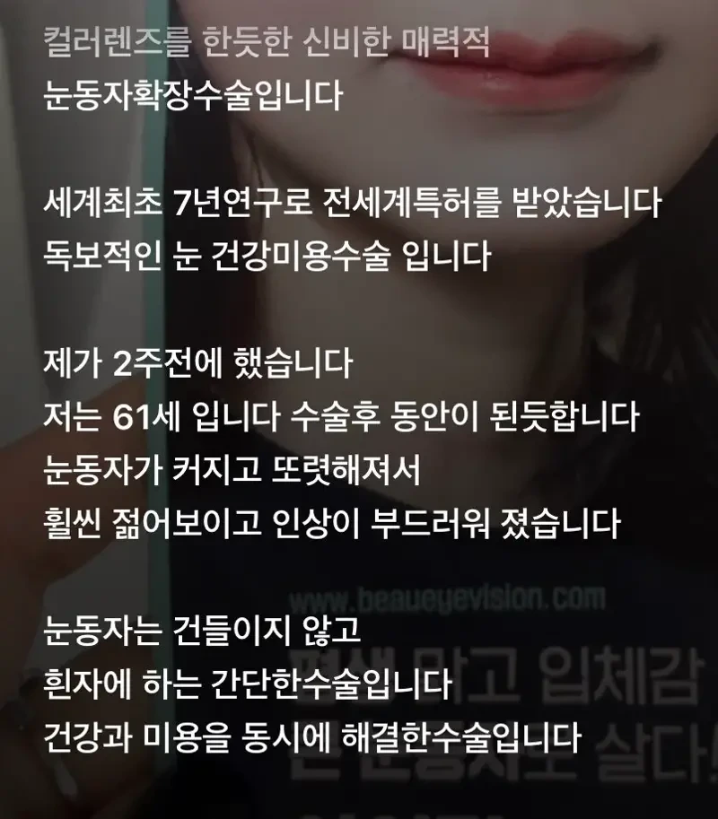 요새 유행한다는 눈 수술 | 인스티즈