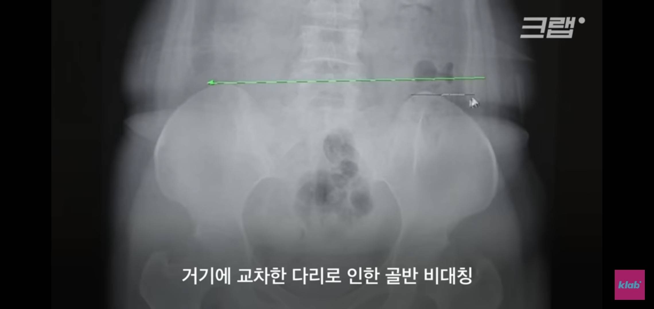 의자 위에서 양반다리가 편한 사람은 허리가 약한 것.jpg | 인스티즈