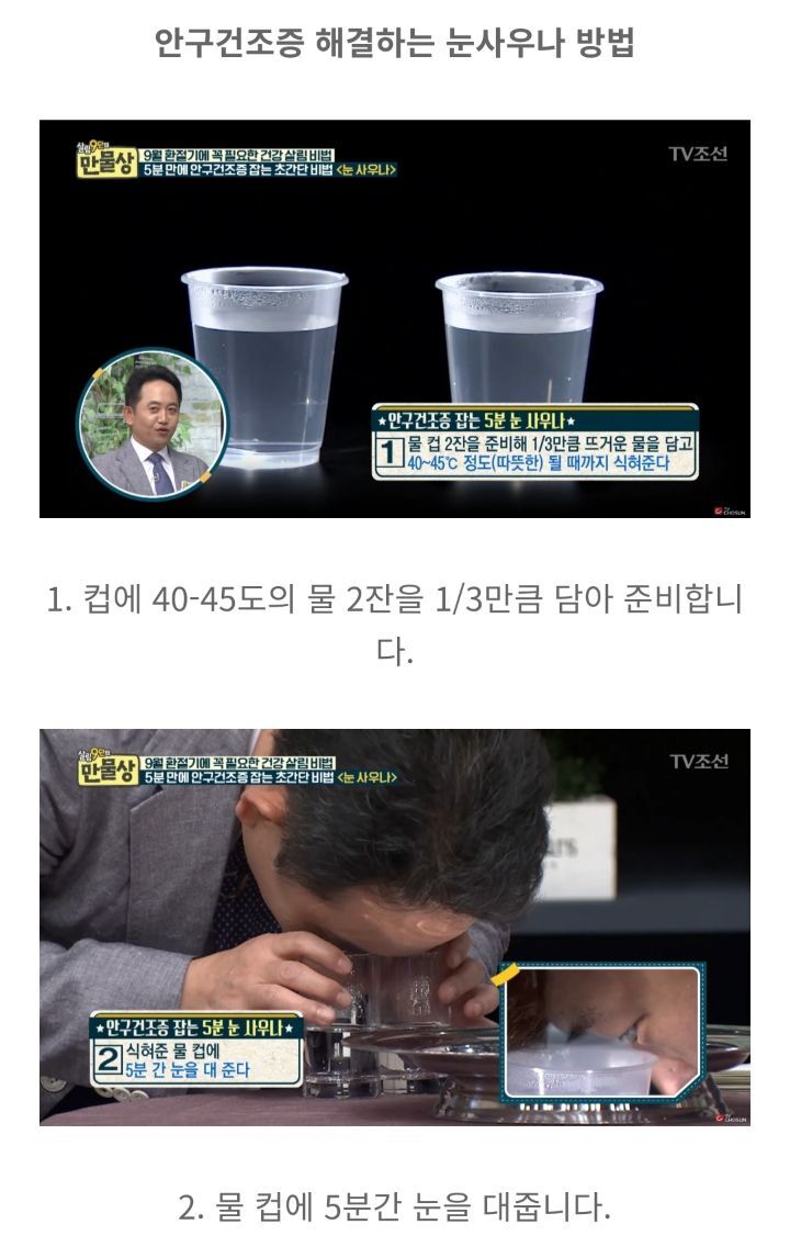 하루 5분 " 안구건조증 " 싹 낫게해주는 "눈사우나" | 인스티즈