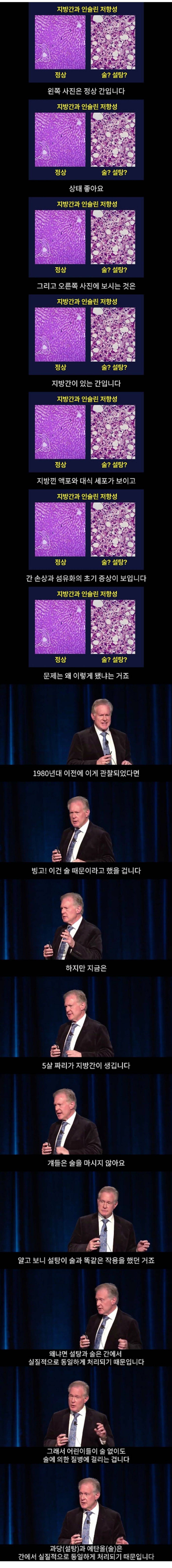 술도 안마시는 5살 아기에게 지방간이 생기는 이유 | 인스티즈