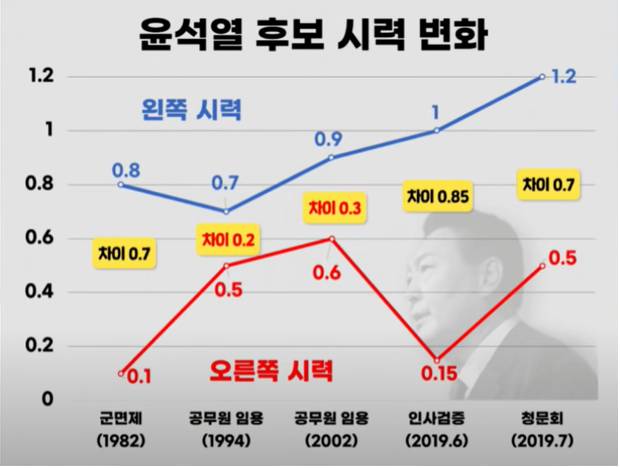 10석열의 군면제 사유인 선택적 부동시 조작 스킬 | 인스티즈