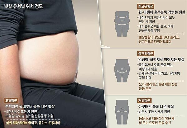 뱃살 유형별 위험 정도 | 인스티즈