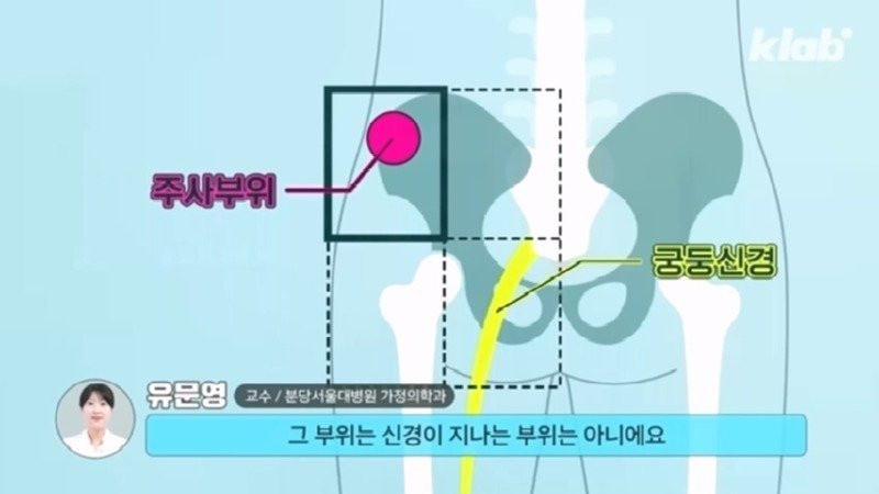 외국에서 안 하는 엉덩이 주사를 한국은 계속 하는 이유 | 인스티즈