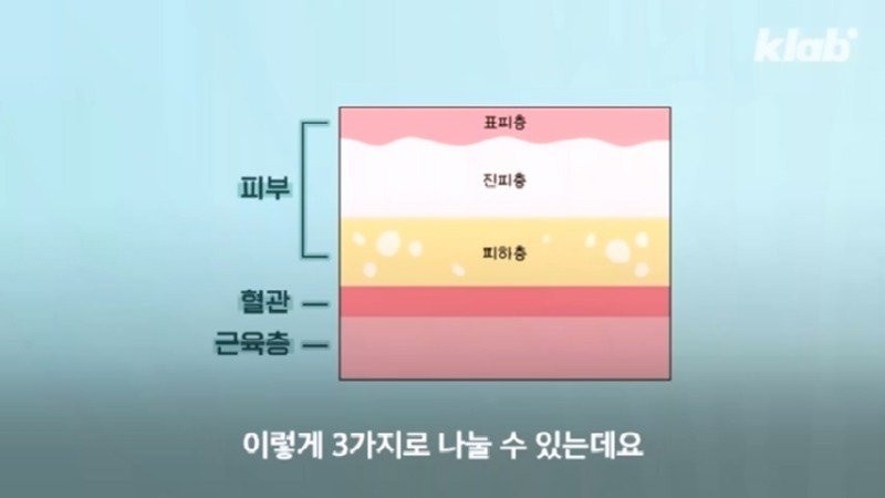 외국에서 안 하는 엉덩이 주사를 한국은 계속 하는 이유 | 인스티즈