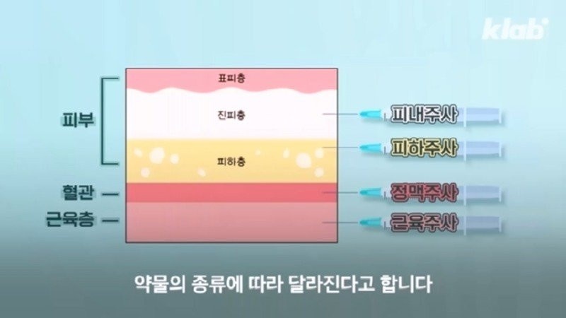 외국에서 안 하는 엉덩이 주사를 한국은 계속 하는 이유 | 인스티즈