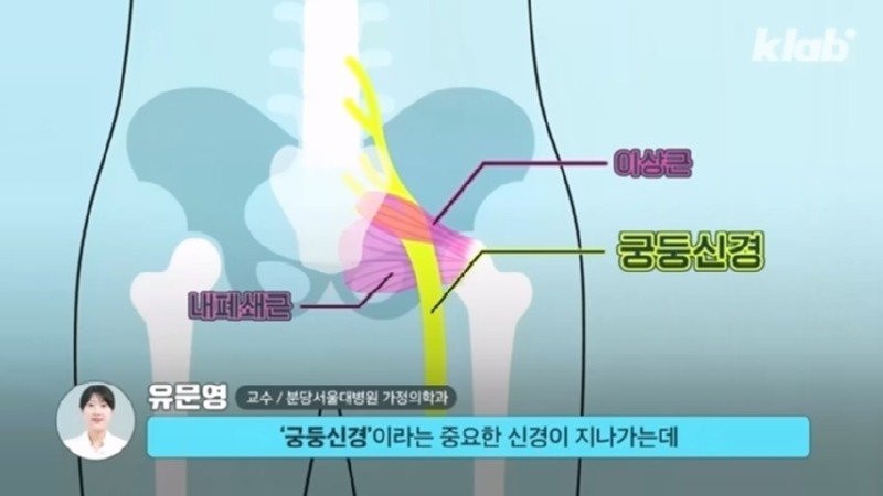 외국에서 안 하는 엉덩이 주사를 한국은 계속 하는 이유 | 인스티즈