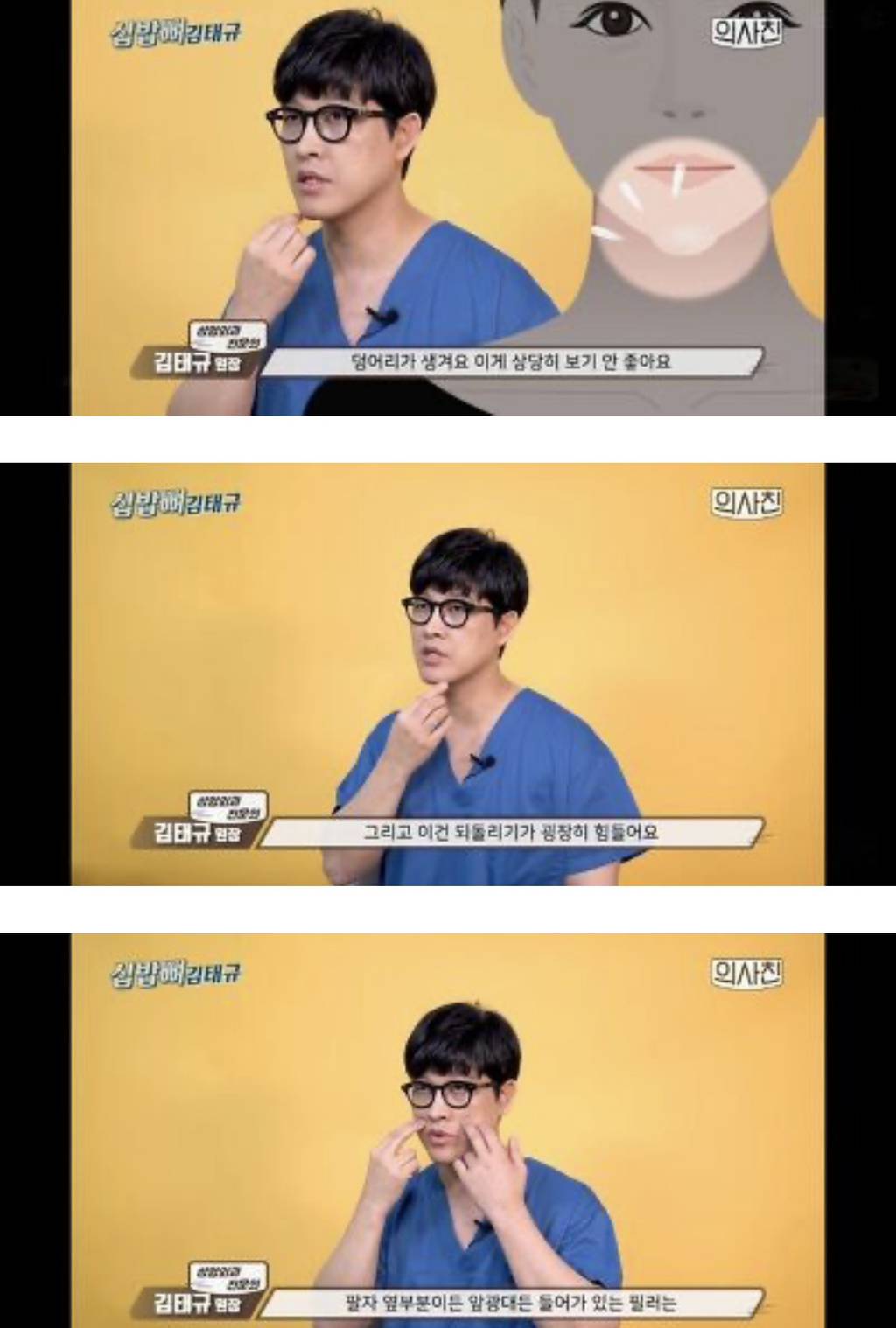 [필러 부작용] 의사피셜 필러 절대 맞지 말아야 할 4군데 | 인스티즈