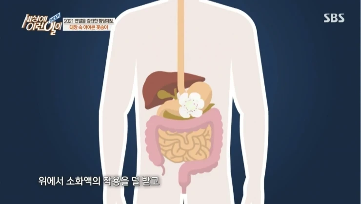 대장내시경하다 발견된거 | 인스티즈