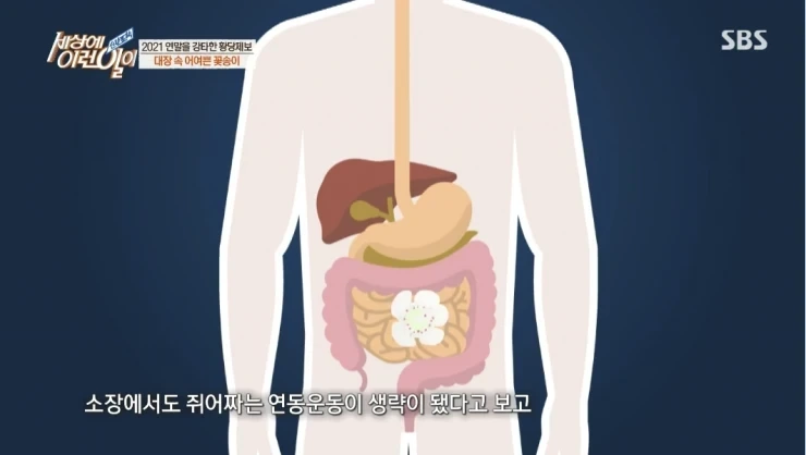 대장내시경하다 발견된거 | 인스티즈