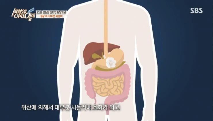 대장내시경하다 발견된거 | 인스티즈