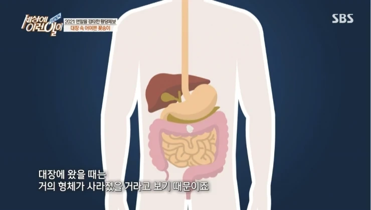 대장내시경하다 발견된거 | 인스티즈