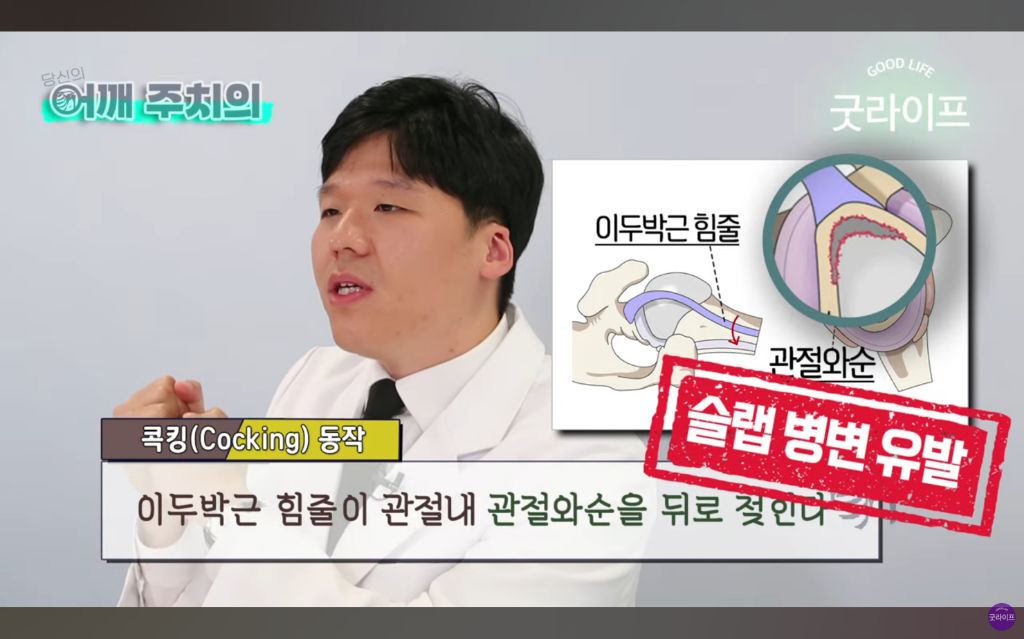 대부분의 상체운동은 하면 안된다는 정형외과 의사 | 인스티즈