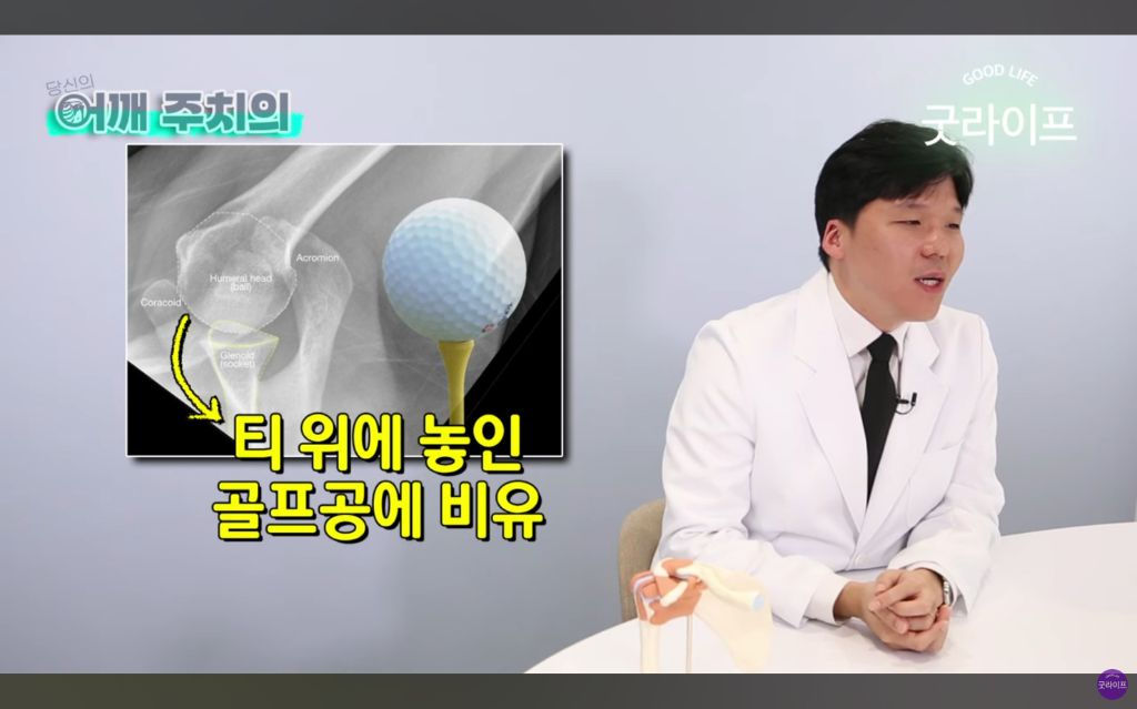 대부분의 상체운동은 하면 안된다는 정형외과 의사 | 인스티즈