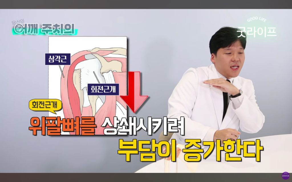 대부분의 상체운동은 하면 안된다는 정형외과 의사 | 인스티즈