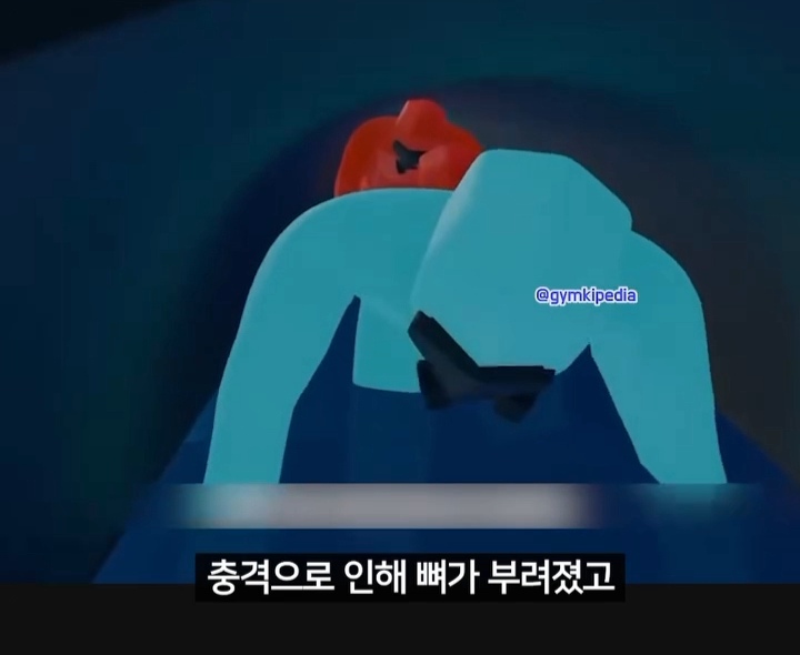 해외에서 소송중인 미친 사건 | 인스티즈