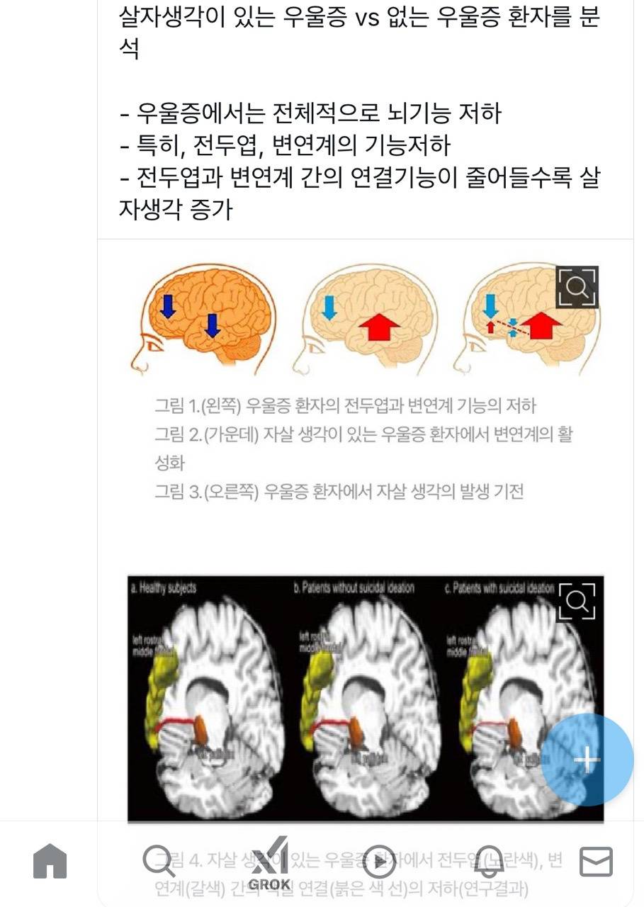 우울증 걸린사람들 의지로 이겨내라는사람한테 보여주고싶네 | 인스티즈