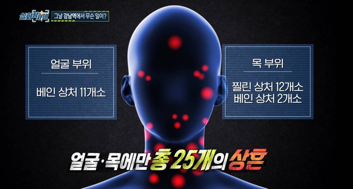 훨씬 잔인했던 강남의대생 살인사건 | 인스티즈