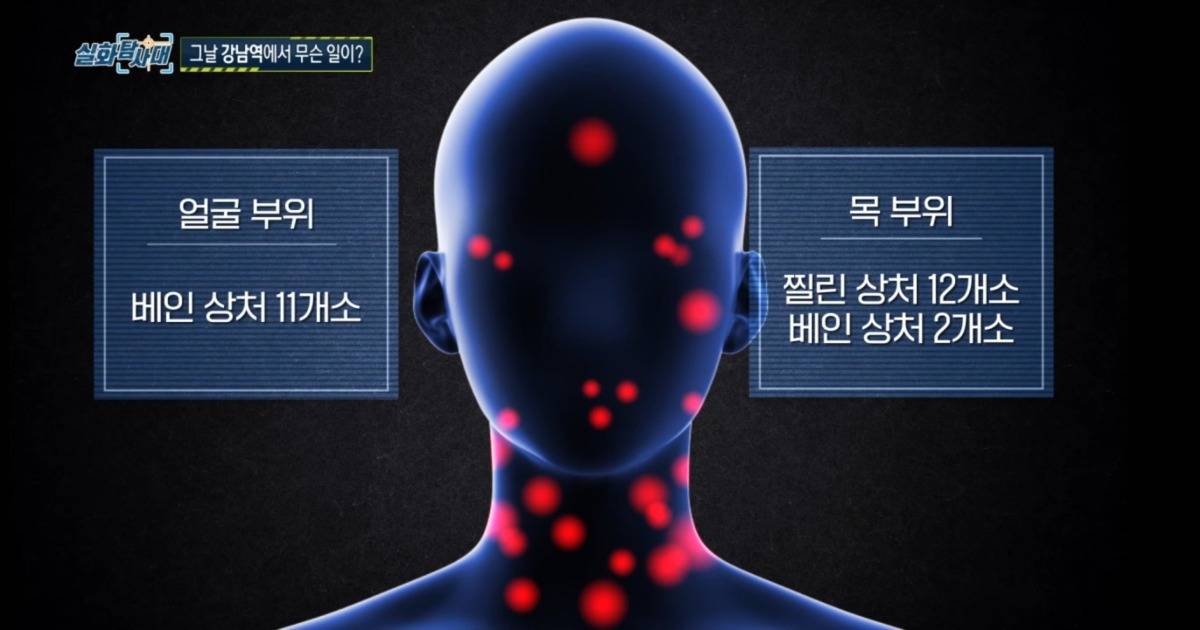 훨씬 잔인했던 강남의대생 살인사건 | 인스티즈