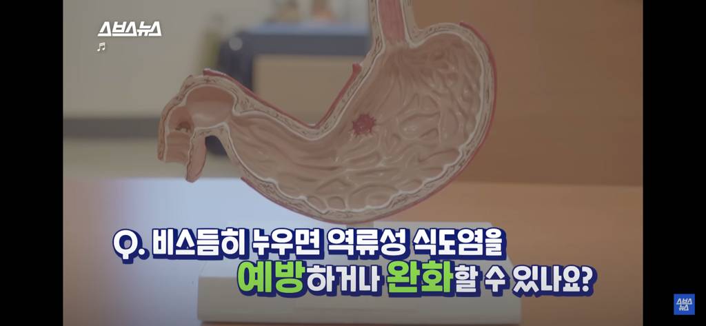 밥 먹고 누우면 역류성 식도염.. 비스듬히 누우면 안될까? | 인스티즈