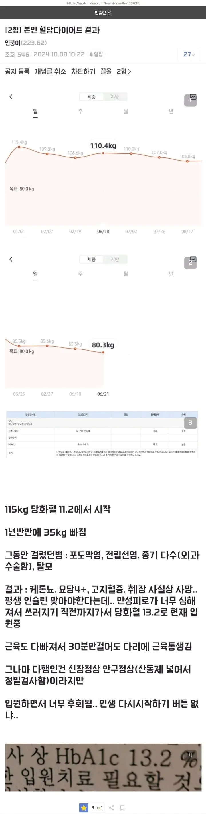 절대 하면 안되는 당뇨 다이어트를 한 사람 | 인스티즈