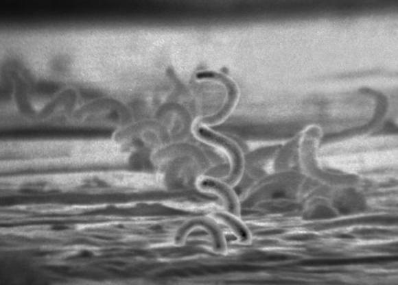 성관계 후 10년 동안 멀쩡하다가 '실명'…韓서 급증했다는 '이 병' | 인스티즈