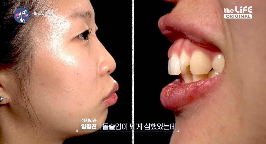 렛미인 후속 프로그램 같다는 make me girl (맥미걸).jpg | 인스티즈