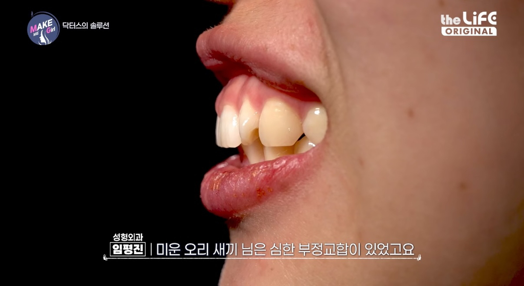 렛미인 후속 프로그램 같다는 make me girl (맥미걸).jpg | 인스티즈