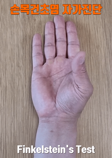 손목 건초염 자가진단법.gif | 인스티즈