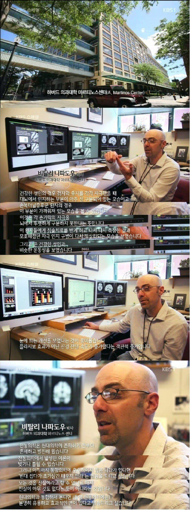 미국의사들이 놀라는 한의학의 우수한 효능 | 인스티즈