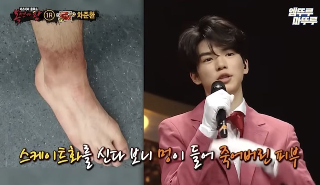 차준환 발목상태 | 인스티즈