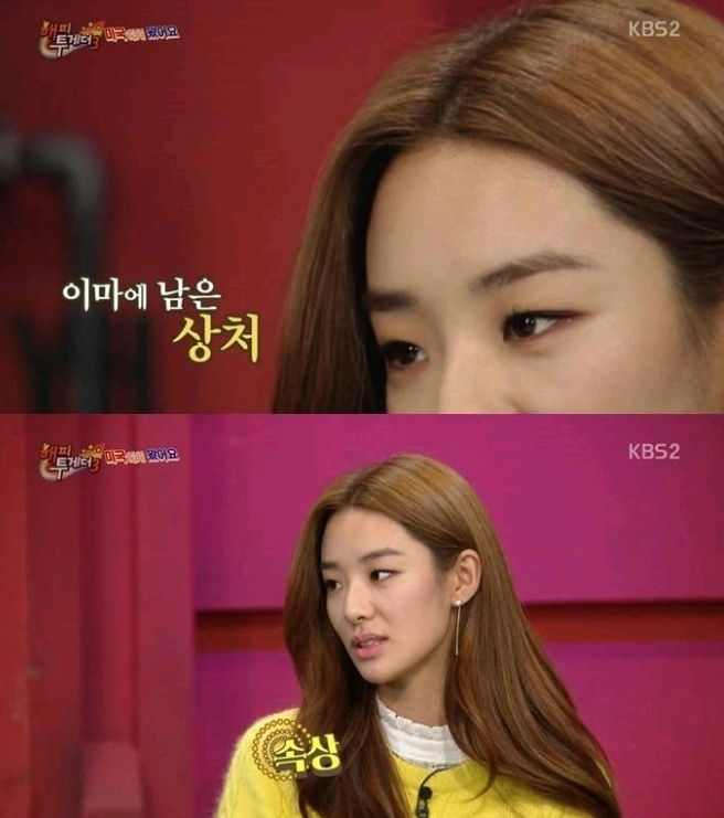 미국 출신 연예인들이 당한 인종차별 | 인스티즈