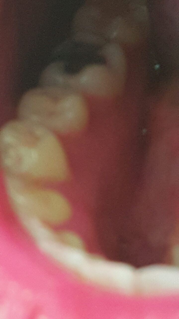 내가 얼마나 이를 잘 닦고 있나... 치면착색제 사용 후기 | 인스티즈