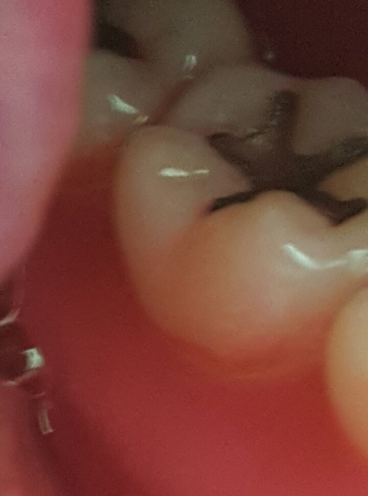 내가 얼마나 이를 잘 닦고 있나... 치면착색제 사용 후기 | 인스티즈