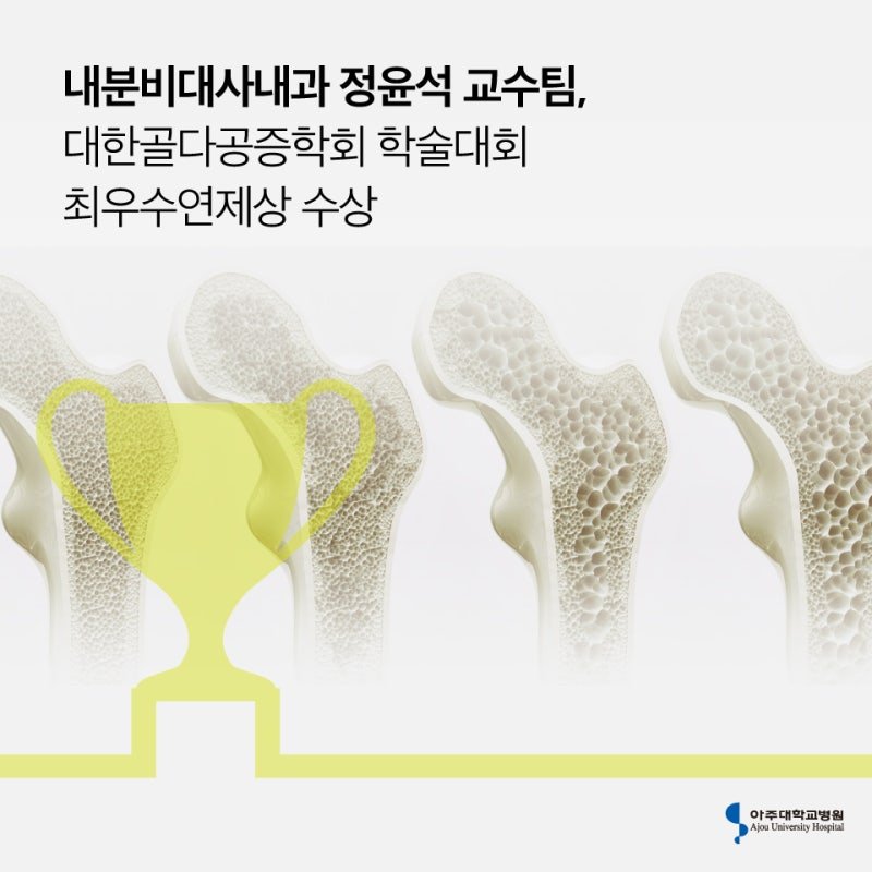 ‼️출산전 출산후 산모 뼈상태라고 돌아다니는 짤 주작임‼️ | 인스티즈