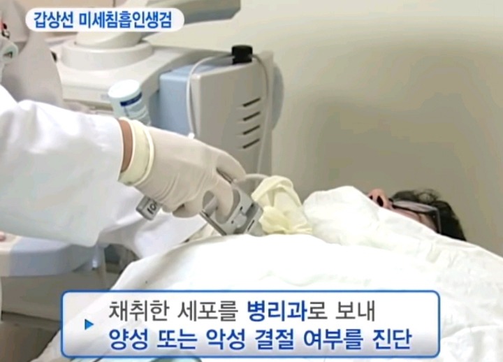 실제 갑상선 혹 조직검사 | 인스티즈