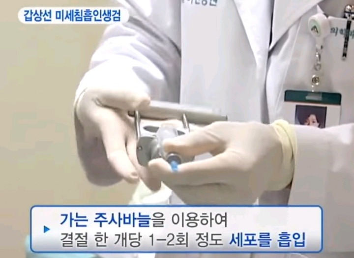 실제 갑상선 혹 조직검사 | 인스티즈