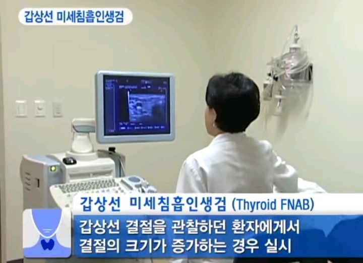 실제 갑상선 혹 조직검사 | 인스티즈