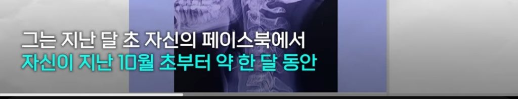 태국서 목 비트는 마사지 받은 가수,전신마비 끝 숨져.. | 인스티즈