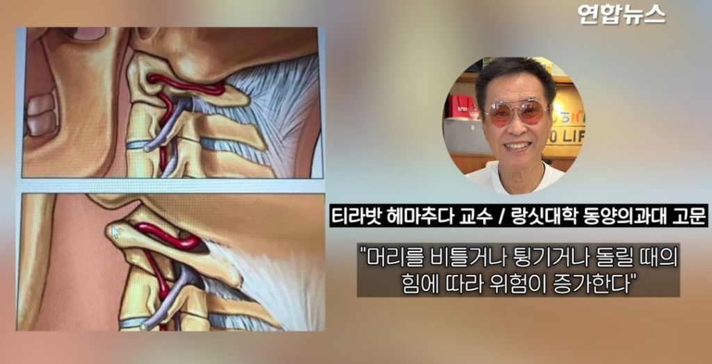 태국서 목 비트는 마사지 받은 가수,전신마비 끝 숨져.. | 인스티즈