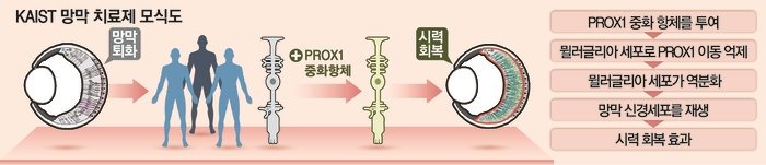 떨어진 시력도 회복 가능.. 세계최초로 망막 재생 성공 | 인스티즈