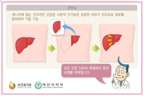 나는 부모님께 간이식 해드릴 수 있다? 없다? | 인스티즈