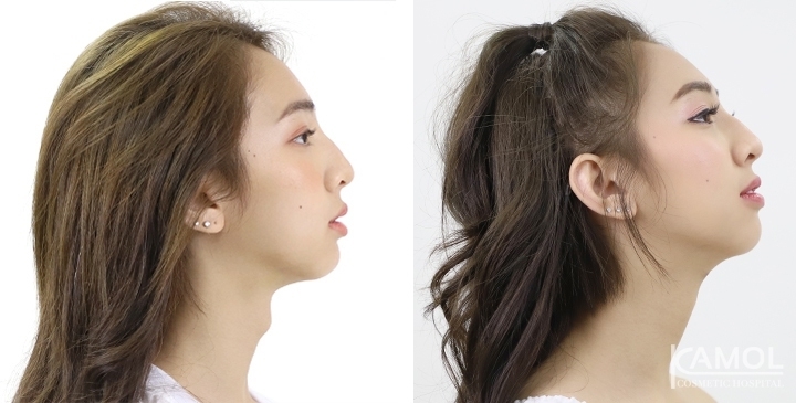 대체 트젠들은 *여성화*를 위해 얼마를 쓸까? | 인스티즈
